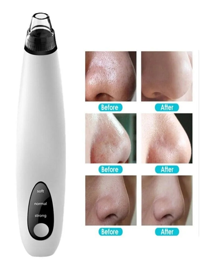PoreClear Vacuum Extractor